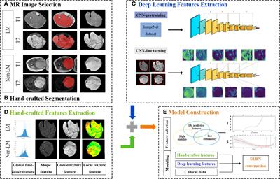 Deep Learning Radiomics Nomogram to Predict Lung Metastasis in Soft-Tissue Sarcoma: A Multi-Center Study